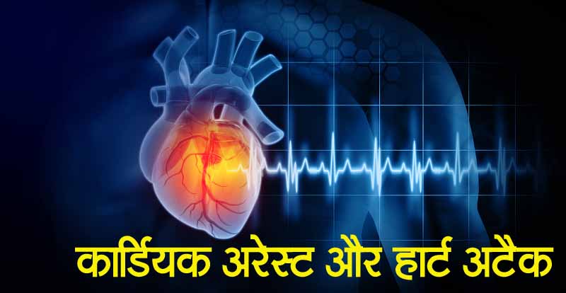 हार्ट अटैक से बेहद खतरनाक है कार्डियक अरेस्ट, मिनटों में हो जाती है मौत… ऐसे रखें ध्यान