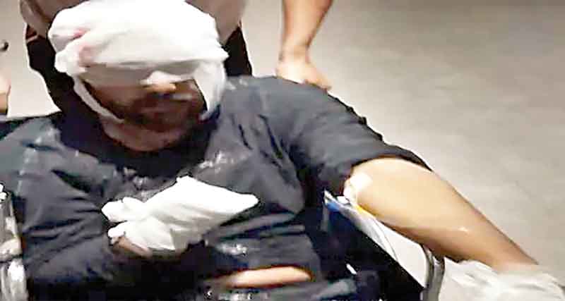 Punjab News: बाजू काटी, आंखें नोच डालीं, जालंधर के सूर्या एन्क्लेव में युवक  पर टूटे बदमाश - divya himachal