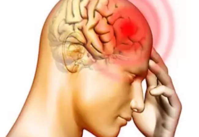 ब्रेन स्ट्रोक या लकवा मारने पर घबराएं नहीं, मैकेनिकल थ्रोम्बेक्टोमी से उपचार संभव