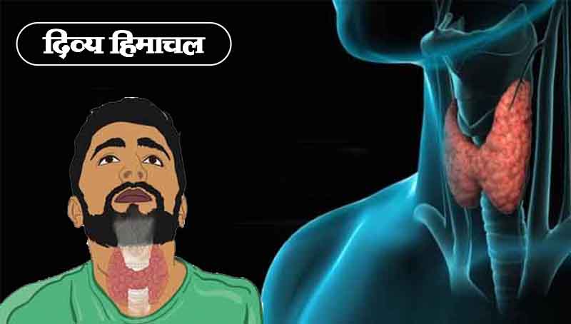 Thyroid : क्या होता है थायराइड और क्या-क्या होते हैं इसके लक्षण, आइए जानते हैं यहां