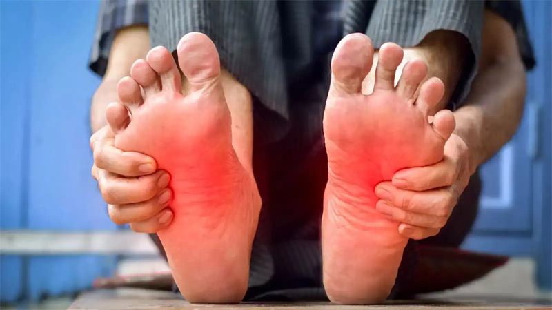 किस विटामिन की कमी से तलवों में होती है जलन? जानें इससे राहत के उपाय